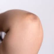 Lbows