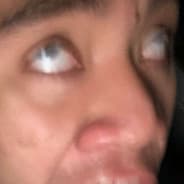 Sperg