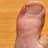 Toe