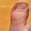 Toe