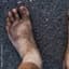 Homeless feet