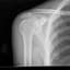 Shoulder_Roll