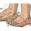 SmellyToes