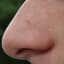 Nose