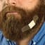 BeardHurts